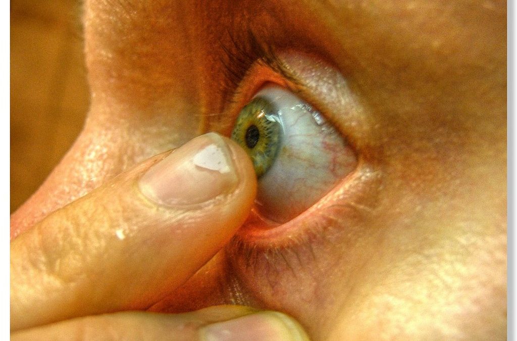 How Long Do You Typically Wear a Bandage Contact Lens?