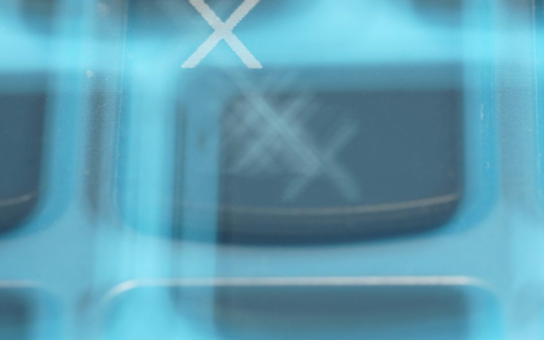 What Are the 4 Types of Cataracts?