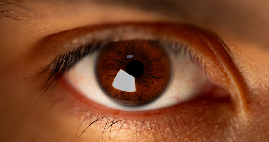 Photo Online Eye Tests Accuracy