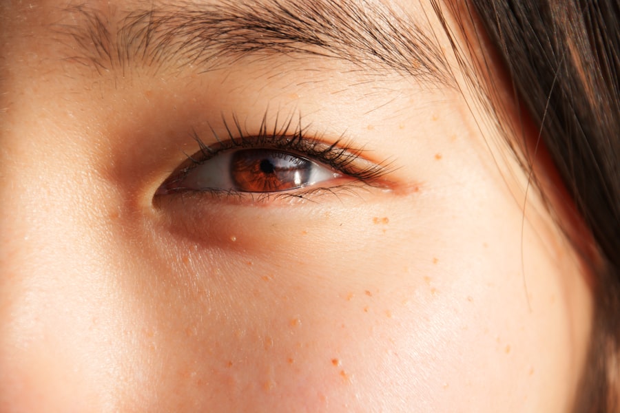 Photo Dry Eye Relief Tips