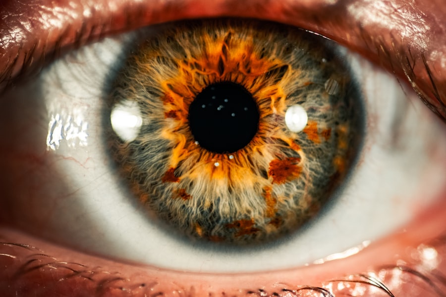 Eye Color Can Reveal About Your Health