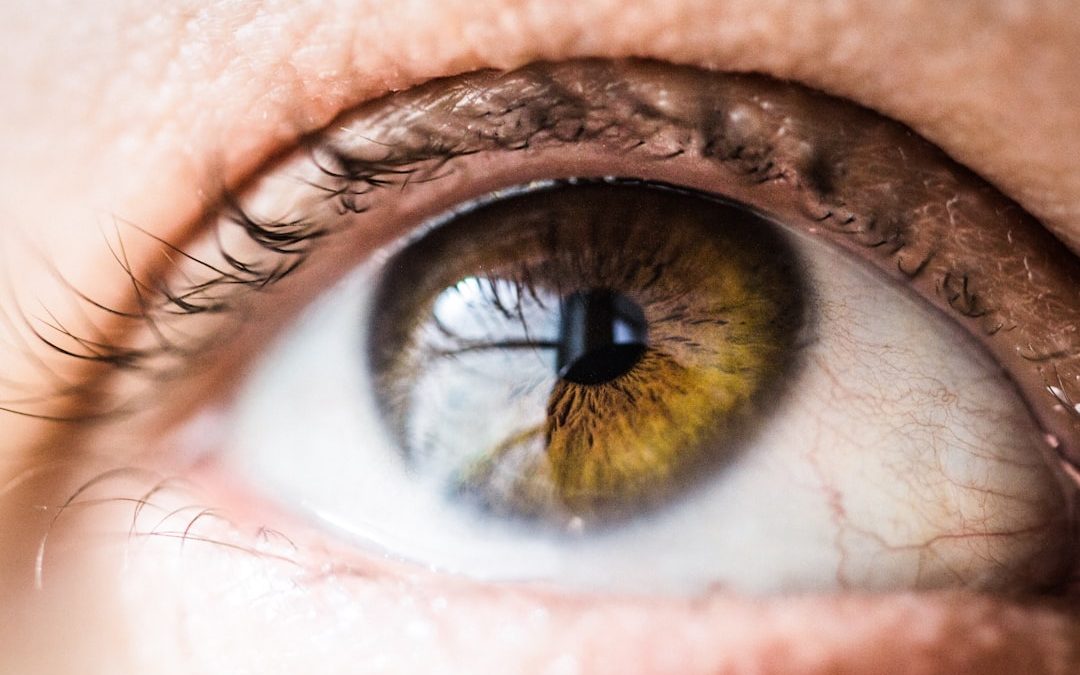 What Your Eye Color Can Reveal About Your Health