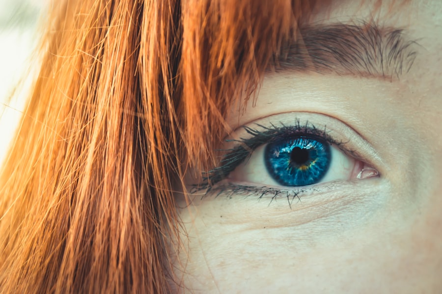 Photo Eye Color Can Reveal About Your Health
